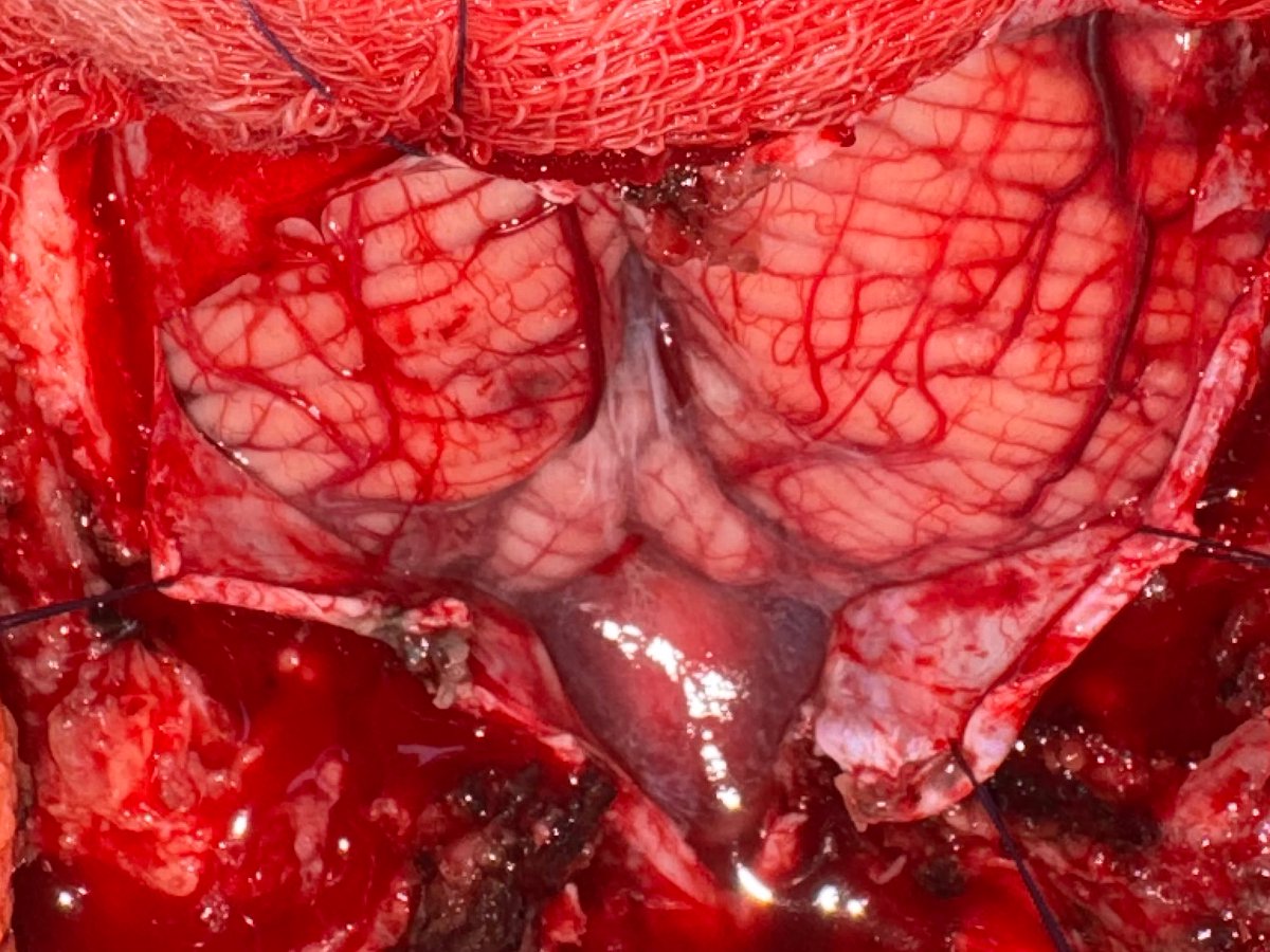 Cerebellum and BrainStem
🧠 Coordination and Reapiratory center in Brain 🧠
