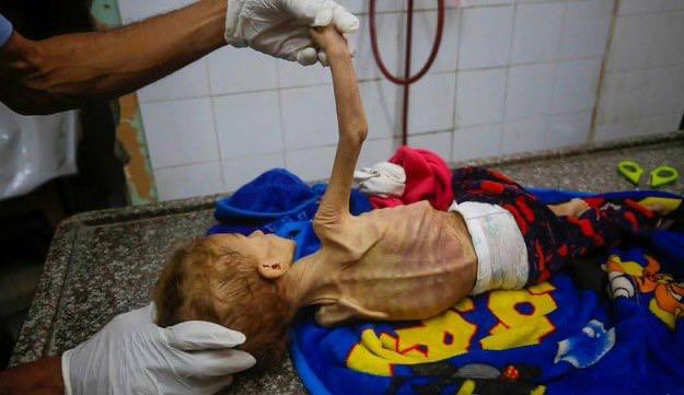 furkanhareketi's tweet photo. GAZZE AÇLIKTAN ÖLÜYOR! 

GAZZE'Yİ UNUTMA, UNUTTURMA!

#GazzeAçlıktanÖlüyor