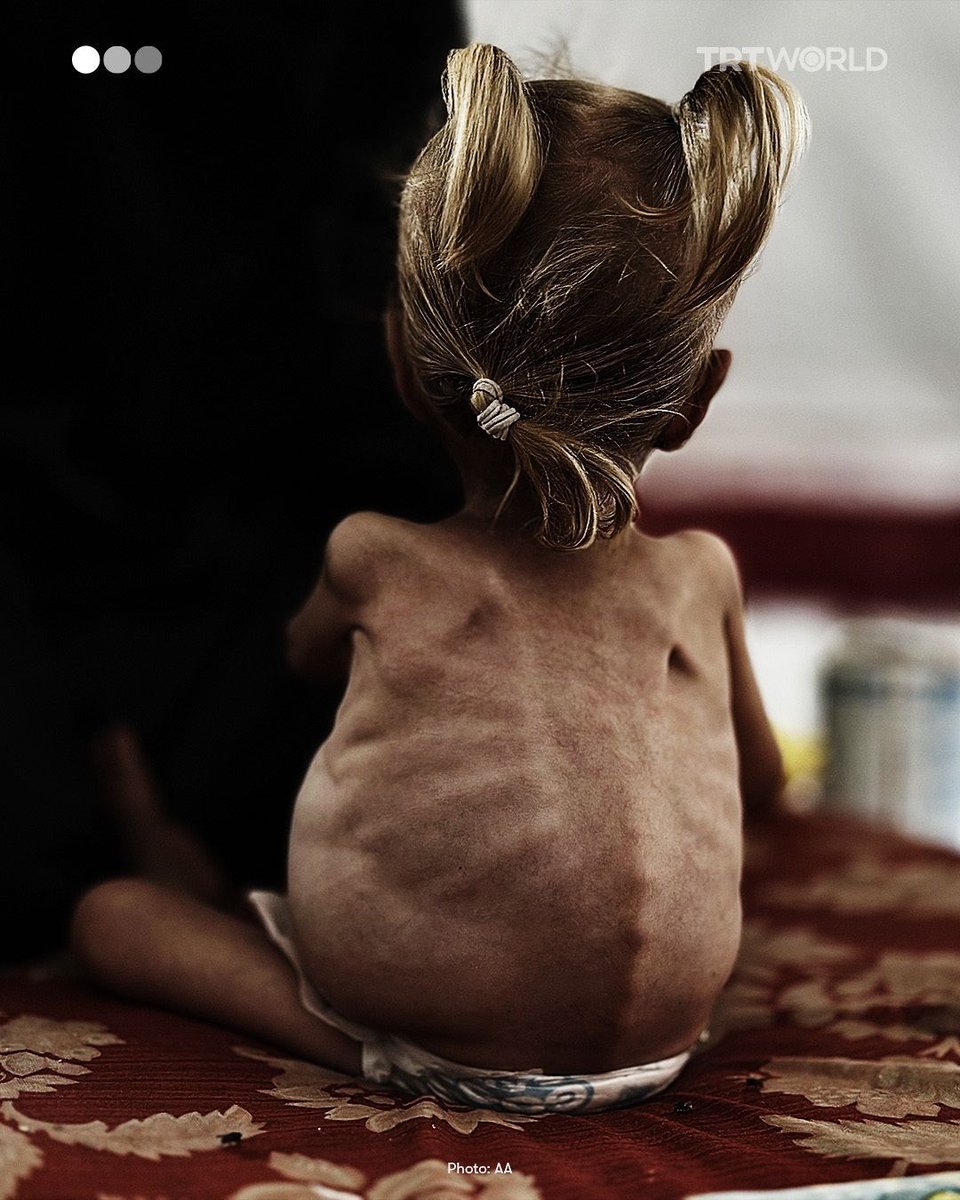 JuanDiegoBotto's tweet image. Is Europe really going to allow hundreds of thousands of children to die of hunger in Gaza? Will it do nothing to break the Israeli blockade? Not even a sanction, not even a single measure of pressure in the midst of a genocide?