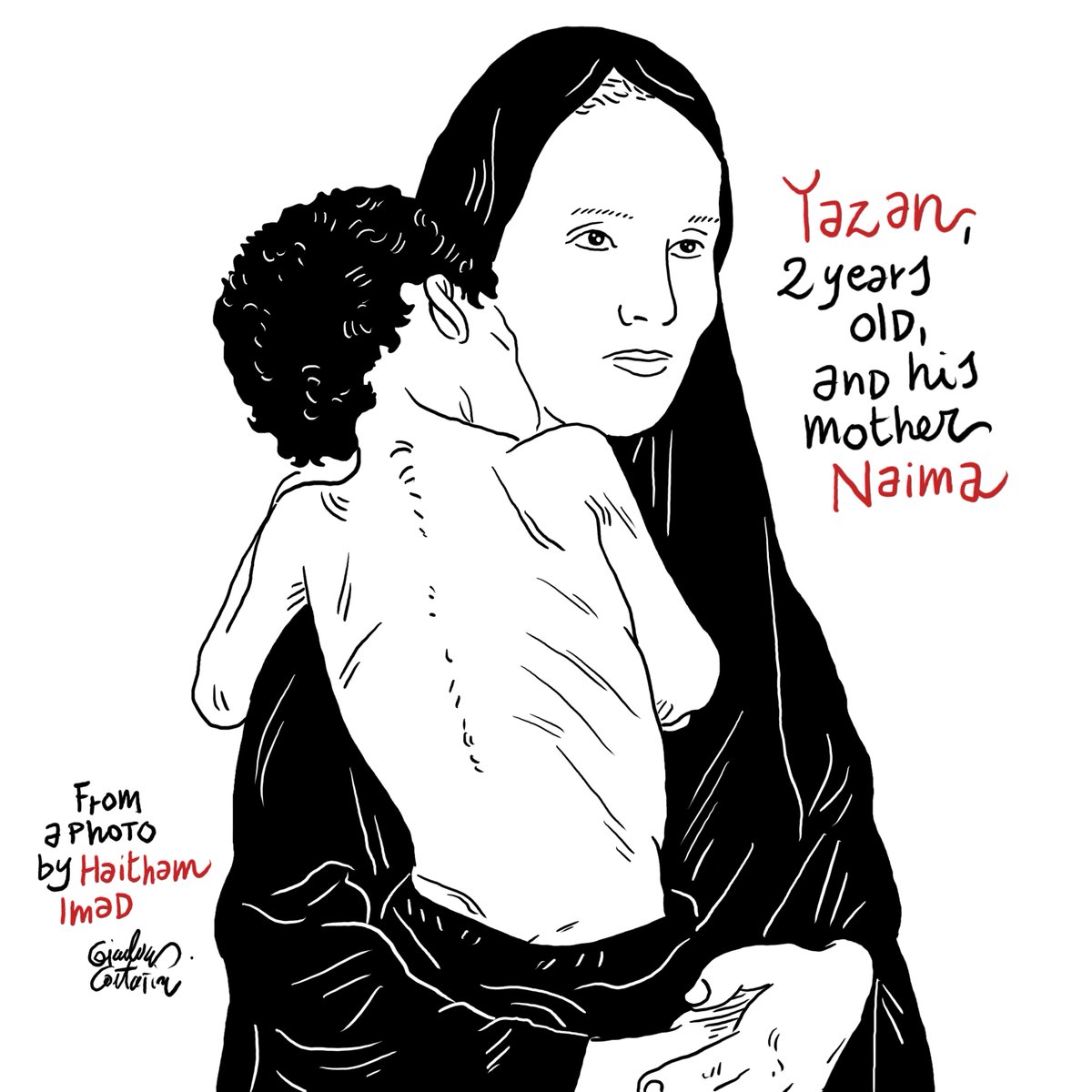 channeldraw's tweet image. Two-year-old Palestinian Yazan, cared for by his mother Naima, suffers from severe malnutrition due to food shortages caused by the #Gaza blockade and closed borders, at Al-Shati refugee camp, Gaza City, July 19, 2025.
From a photo by Haitham Imad