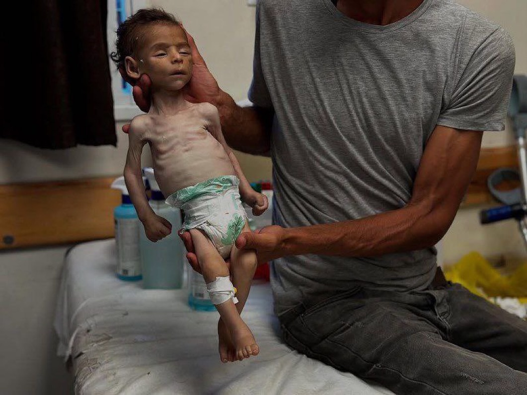 BREAKING: In the last 48 hours, at least five Palestinian CHILDREN have died of STARVATION in Gaza:

- Infant Jawad Al-Anqar (35 days old) died in Gaza City.

- Yahya Al-Najjar, a child from Khan Younis, died at Nasser Hospital.

- Toddler Sanaa Al-Lahham (1.5 years old) died in