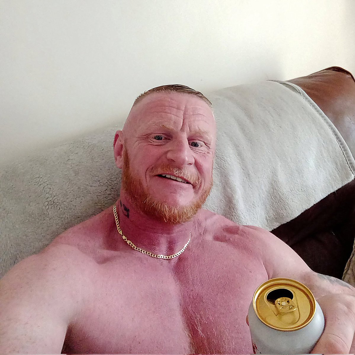 Royston56428882's tweet image. Bbc news is right always get checked out no matter how small you might think the problem is.This is a 2 year difference kidneys ached since going docs im fighting Lymphoma cancer for 2nd time and its been one massive struggle but im alive an happy again 😊