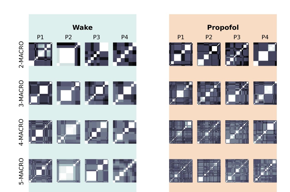 MilinkovBorjan's tweet image. Getting into the nitty gritty, we found drug specific effects. First, propofol and xenon both *elevate* emergence while fragmenting the emergent landscape across the #multiscale #heterarchy. 

7/n