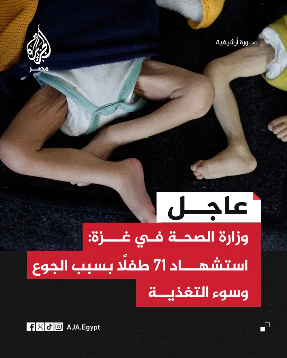 عاجل | صحة غزة: استشهاد 71 طفلًا بسبب الجوع وسوء التغذية