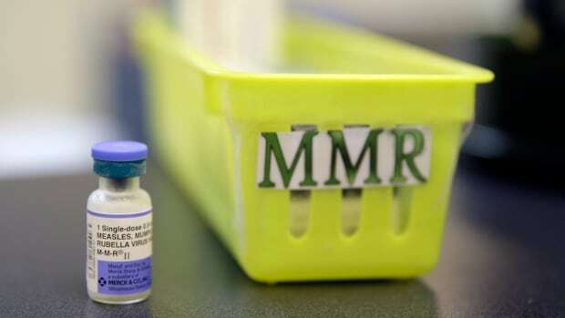 franco_winner_'s tweet photo. Alberta has more measles cases than all of the US combined-spotlighting the urgent need for improved vaccination and public health measures.    https://t.co/oNlVGYyQa2 https://t.co/YnYdYiQs3W