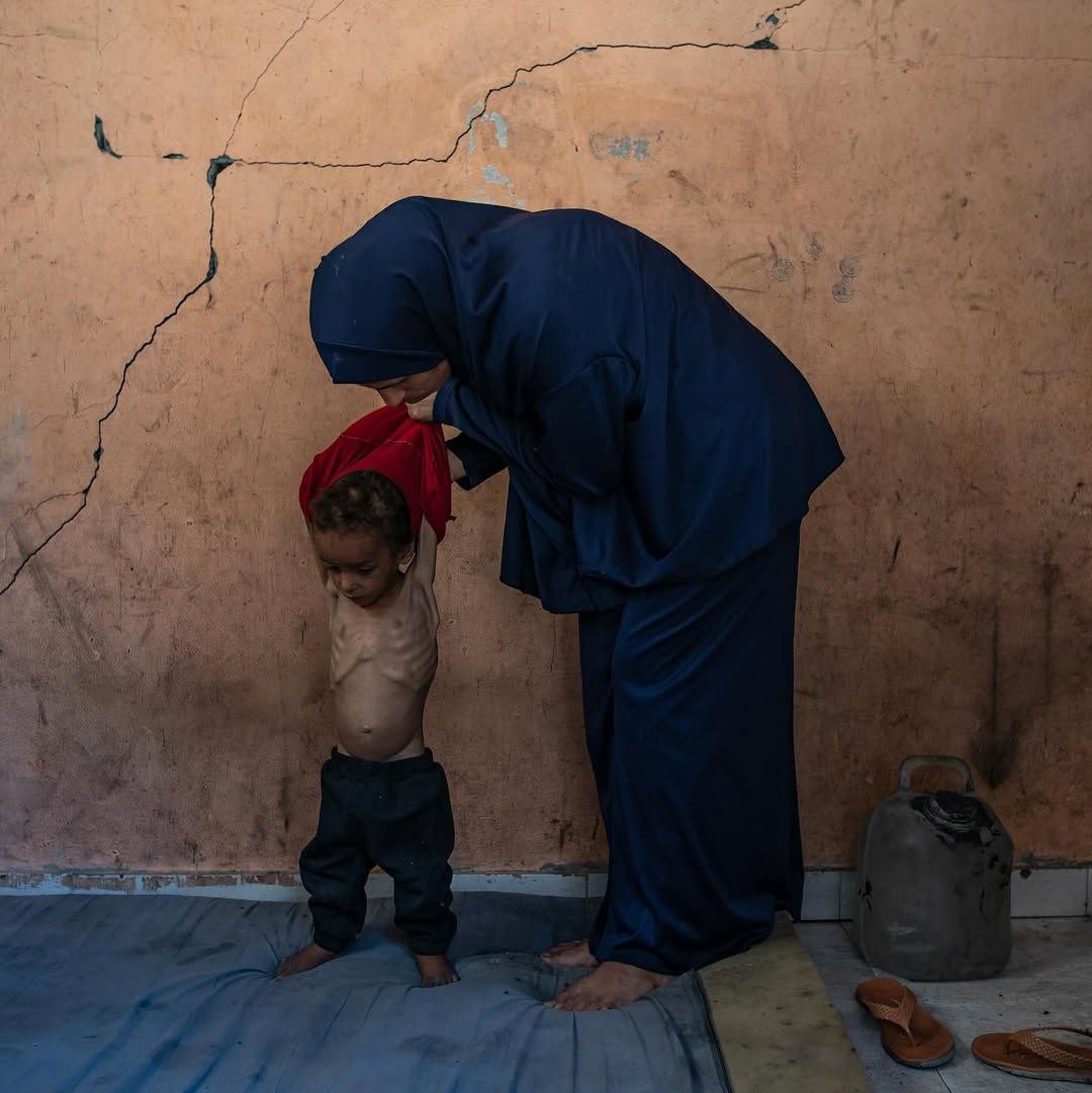 successbyte's tweet photo. Child's in #Gaza are dying of hunger
Does the world just watch! https://t.co/aCx3LNiIeE