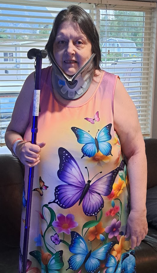 LydiaA1614's tweet image. The fashion is it, but the accessorising really makes the look! #brokenneck #weakKnees I'll be in the collar for 6-8 weeks.