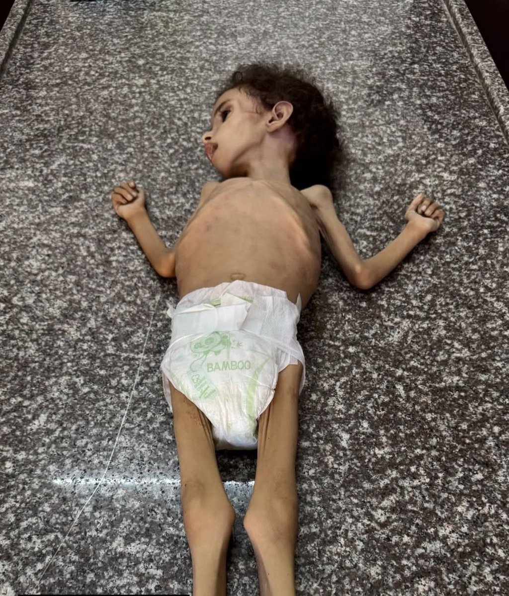 tahiryoldasTR's tweet photo. #GazaStarving 
#StopIsraelWarCrimes

@EmmanuelMacron
@UNICEF @realDonaldTrump @UN @EuropeanUnion36 https://t.co/oLGzK8MhIS