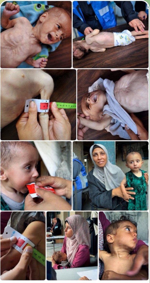 Sadece birkaç gün içinde 800'den fazla Gazzeli açlıktan öldü.