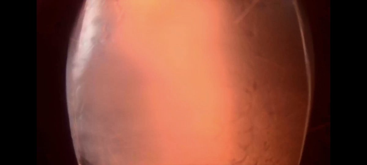 jdoepker79's tweet image. From inside the Flame Trench....