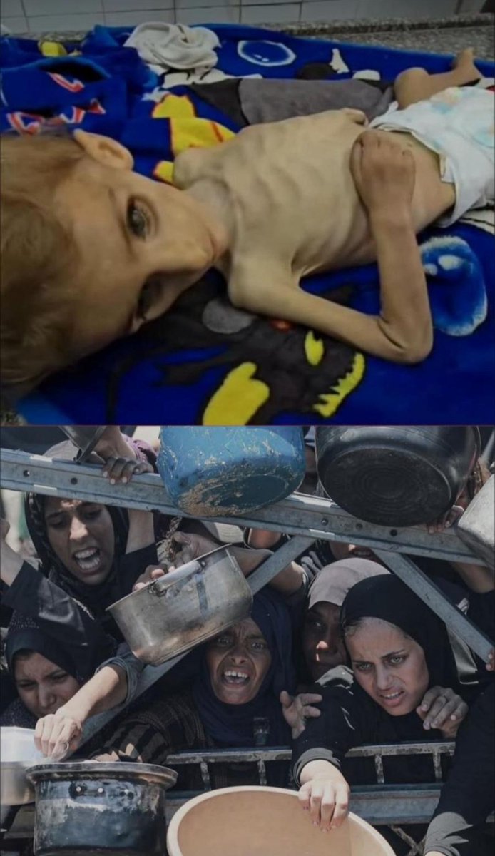 نحن في #غزة نموت جوعا وقهرا وقصفا وتشريدا