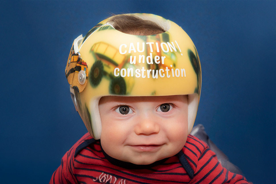 shrinershosp's tweet image. Shriners Children’s New England is proud to introduce a new cranial remolding program, designed to treat infants with acquired head shape abnormalities through expert, customized care. ow.ly/F6A350WlZHM
#ShrinersChildrens #CranialRemolding #parents #SpringfieldMA