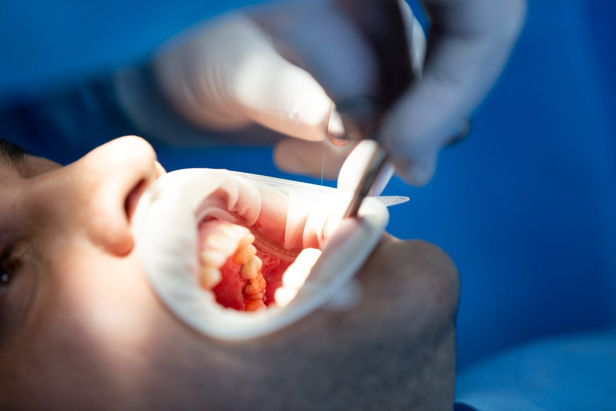 Receding gums? Our expert gum grafting restores lost tissue, protects roots, and creates a healthy, natural gum line. Enhance your smile &amp; prevent future damage with advanced perio-plastic care. Visit us today!

#GumGrafting #MountainPeriodontics #PeriodontalCare #DentalCare