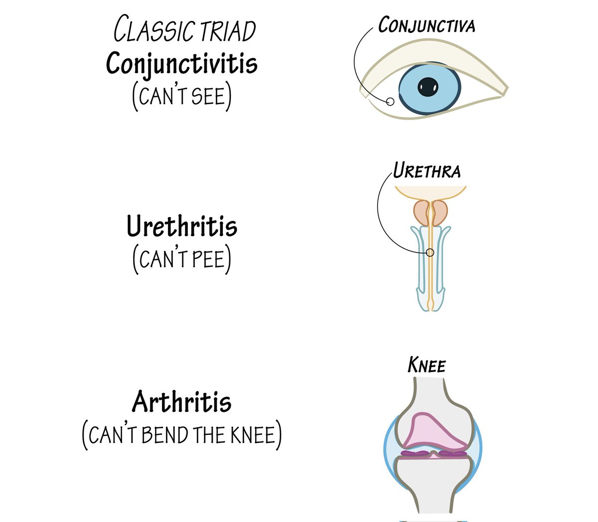 A young male presents with urethritis, conjunctivitis, and arthritis 2 weeks after diarrhea.HLA-B27 positive.
Comment your diagnosis?

A) Psoriatic arthritis
B) SLE
C) Reactive arthritis 
D) Gout