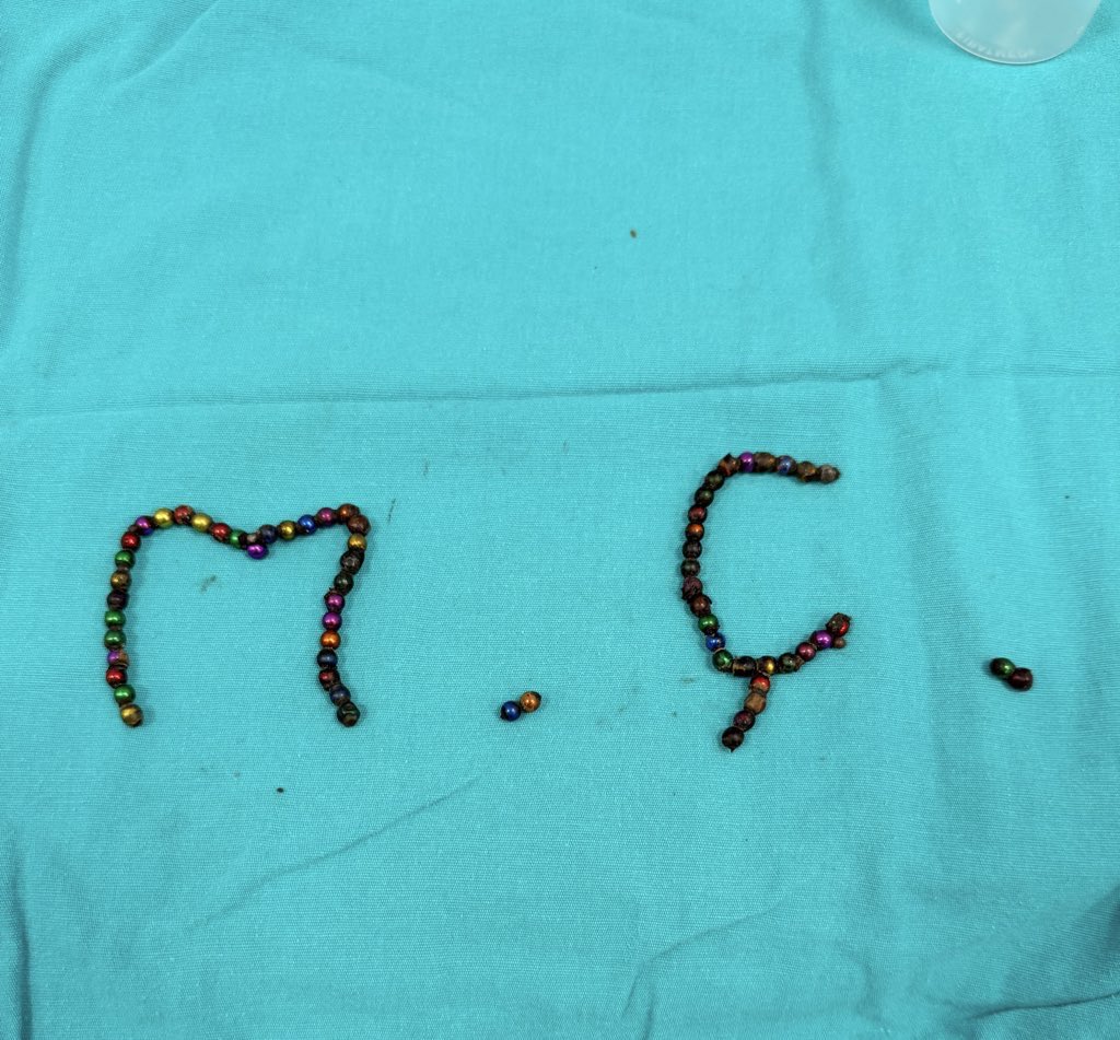 Bu 66 tane magnet boncuk çocuğun iç organlarında 10 yerde delinme yapmıştı. Satışı yasaklanamıyorsa bile bari aileler siz satın almayın. Bu vesileyle zamanla piyasadan kaybolur.