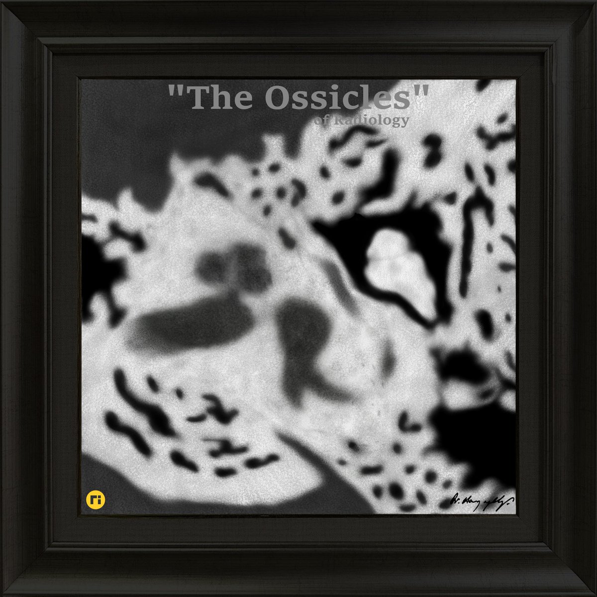 drharunyildiz's tweet image. "The Ossicles"
pixel by pixel handmade!
#radiologicalillustration ✍️