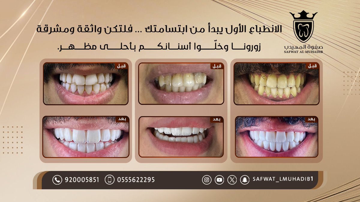 Safwat_lmuhadib's tweet image. ابتسامتك سر تألقك وجمالك الحقيقي ✨
خليها دايماً كاملة مع ابتسامة هوليوود من صفوة المهيدب 😁🦷
💳تقسيط متاح عبر تابي وتمارا
📞920005851 - 0555622295
رابط الحجز المباشر :
almuhadeb-lp.com/x
