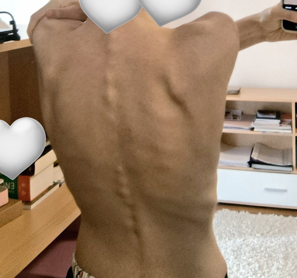 bulimiarch's tweet image. weirdass back bc