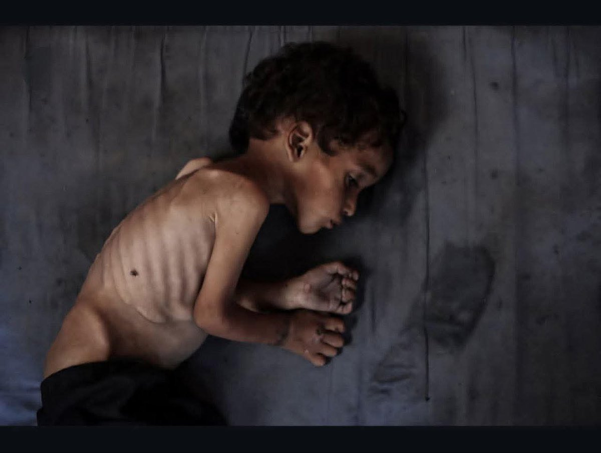ahmd_mhna19696's tweet image. We are falling one after the other from the severity of the famine. I am hungry and everyone is hungry. Things are beyond our capacity. Please donate a little to save lives.
chuffed.org/project/117684…
