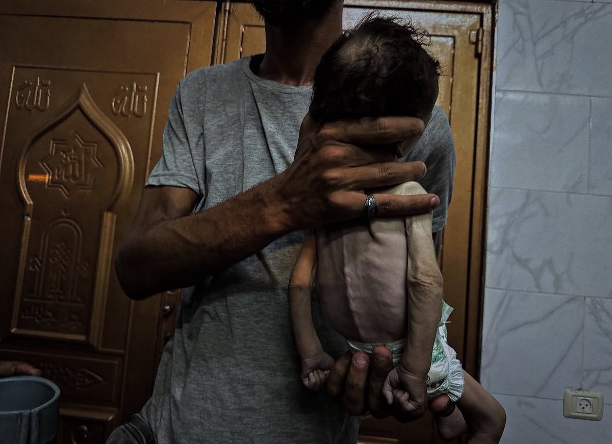 yousef_ki1's tweet photo. Gaza is starving. 

Are you still with us ? Do you hear us !
Reply with 🇵🇸 if you see this pic, pass it ... 💔 https://t.co/6w5GYWoUpB