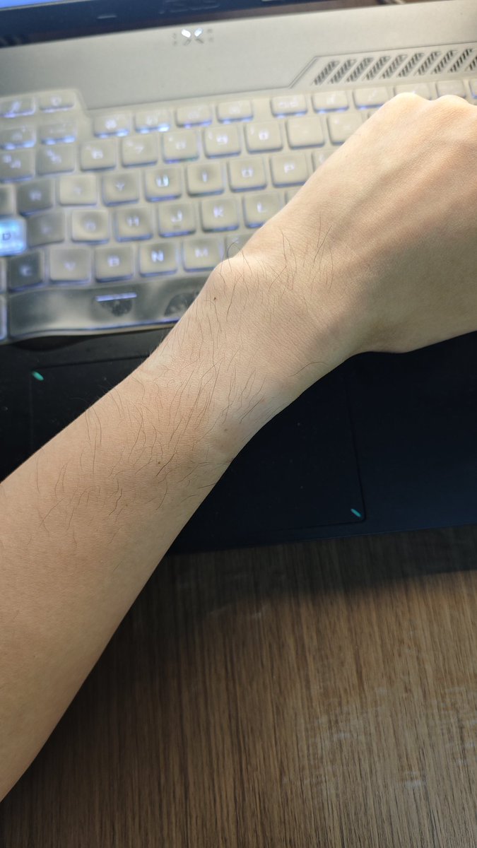 手表戴久了的副作用就是这一块皮肤的色差会很重……🥲