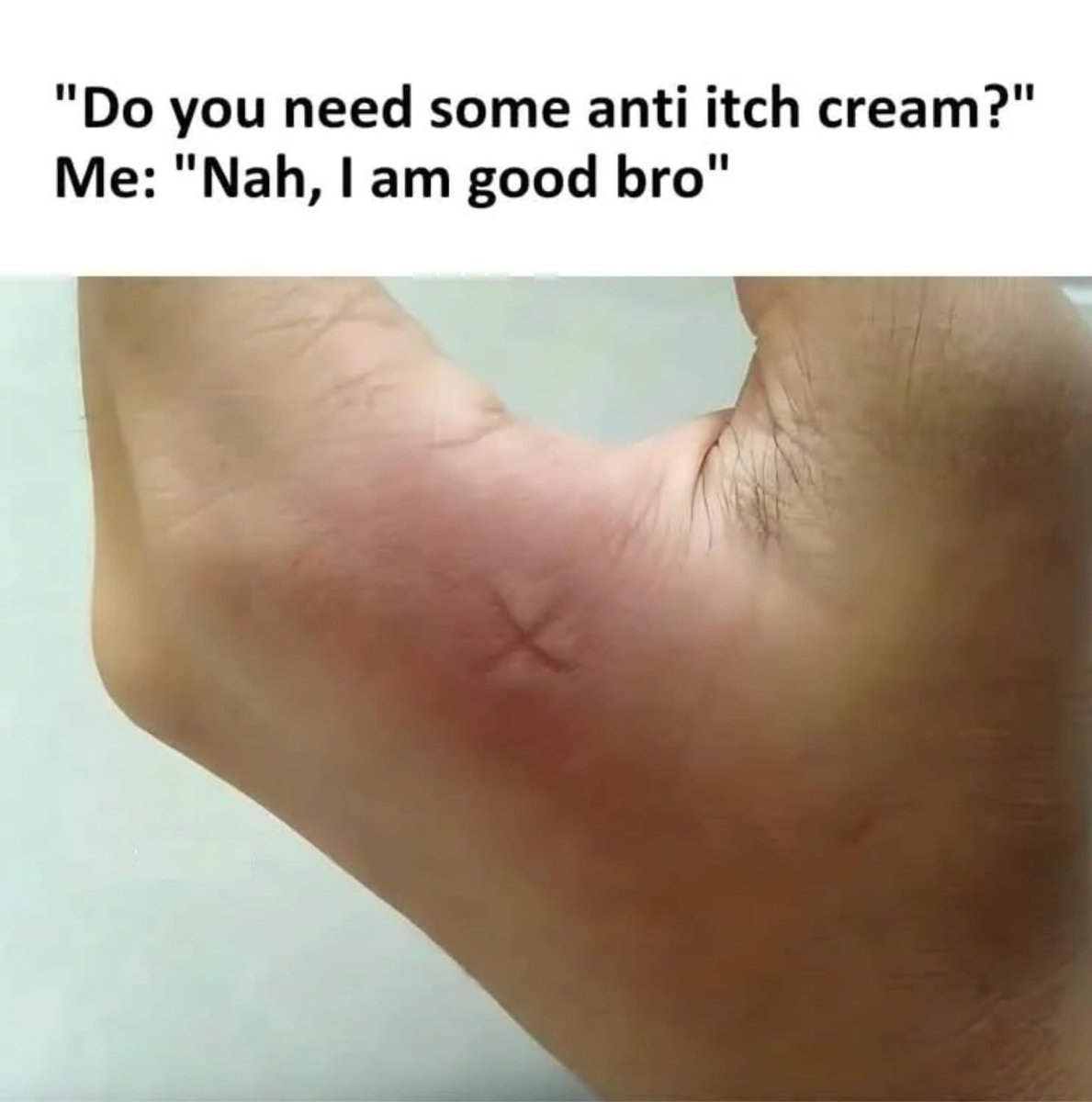 🦟