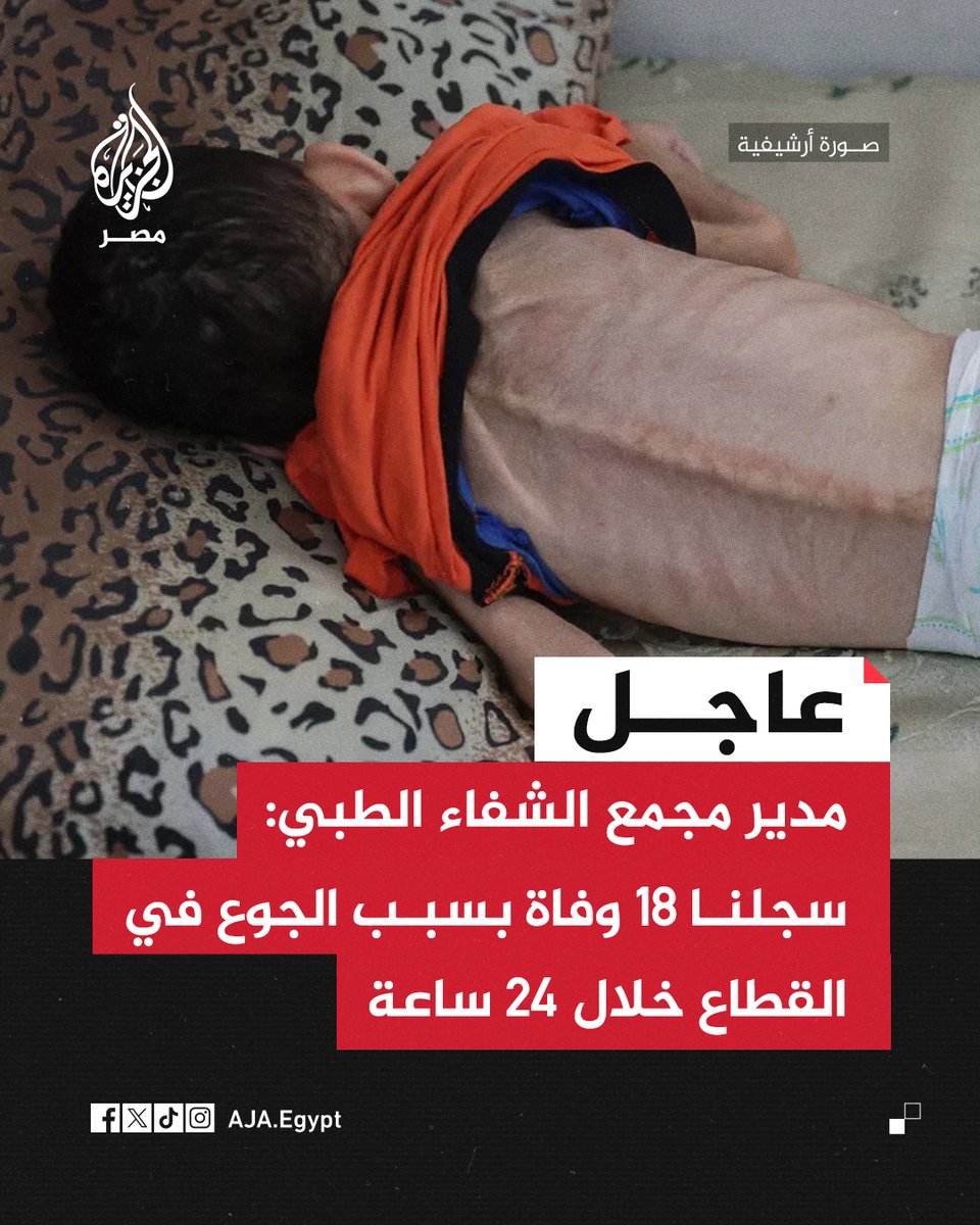 عاجل | وزارة الصحة في غزة: سجلنا 18 وفاة بسبب الجوع في القطاع خلال 24 ساعة