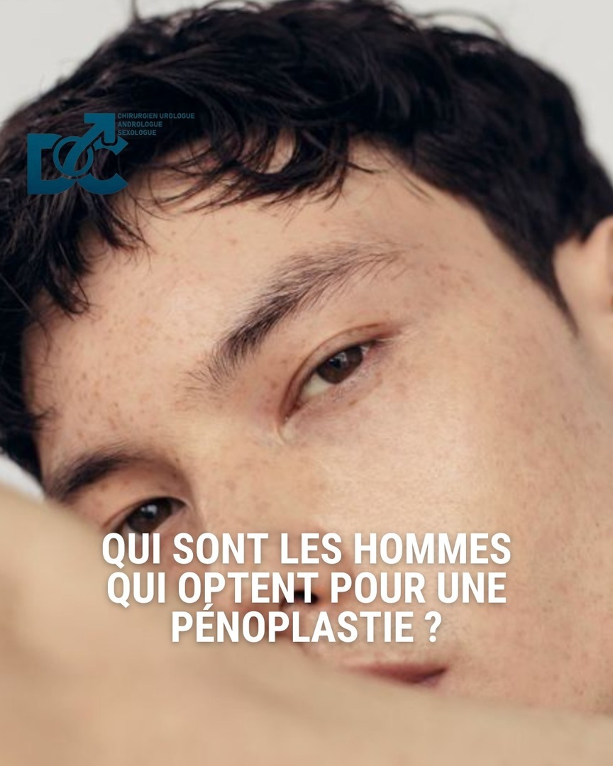 QUI SONT LES HOMMES QUI OPTENT POUR UNE PÉNOPLASTIE ?

Longtemps taboue, la pénoplastie – ou chirurgie intime masculine – attire aujourd’hui des hommes aux profils variés, avec une motivation commune : retrouver confiance en eux et mieux vivre leur intim… instagr.am/p/DMVU8yGNftC/