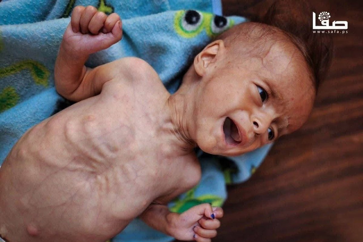 Gazze'de son 24 saatte 18 kişi açlıktan hayatını kaybetti...

Açlıktan ölen çocukların vebali sessizliğini koruyan tüm dünyanın boynuna...

#GazzeAçlıktanÖlüyor