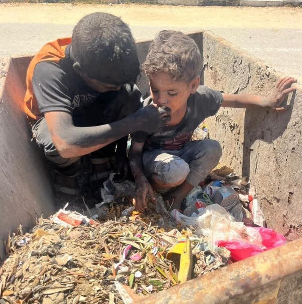 A_M_R_M1's tweet image. 🚨 Gaza is dying of hunger... A systematic starvation campaign is being carried out against its people.