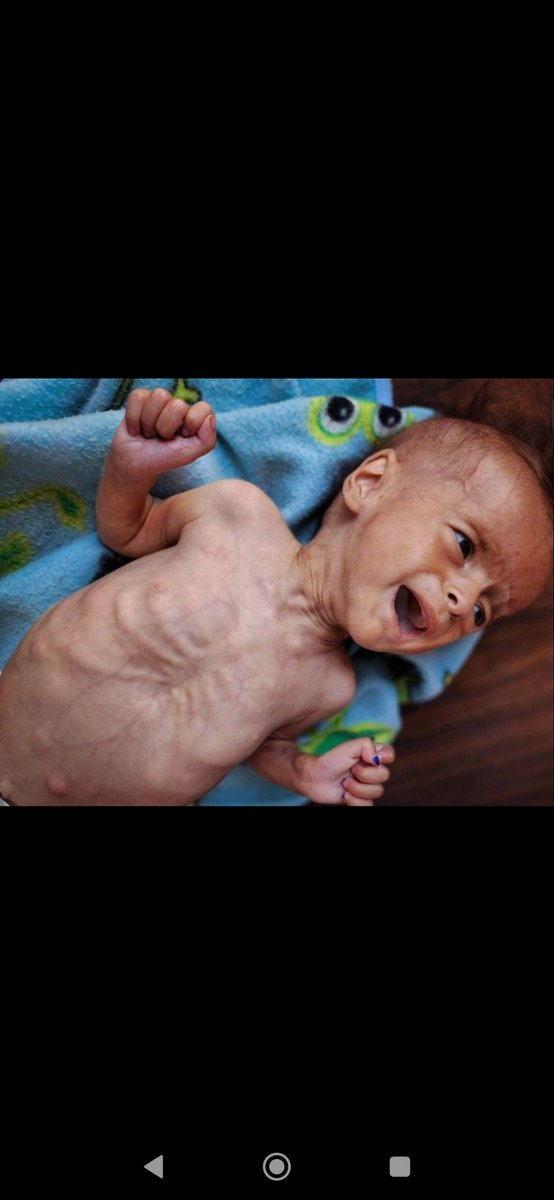 al_ahmd1192's tweet image. Please help and donate to my daughter. Please donate to buy milk. Please.