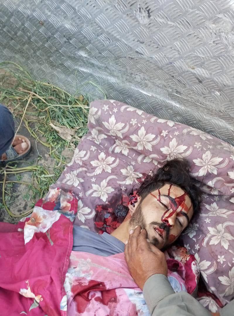 rnk_news1's tweet image. ميليشيات #الجولاني المتواجدين عند نقطة الباغوز يقومون بإطلاق النار على عامل "عبارة مياه" على الضفة الاخرى لنهر الفرات مما أدى لوفاته على الفور
تحاول ميليشيات الجولاني حالياً اشعال الفتنة في مناطق شرق الفرات بعد هزيمتهم في #السويداء
#الجولاني_يقتل_الشعب_السوري