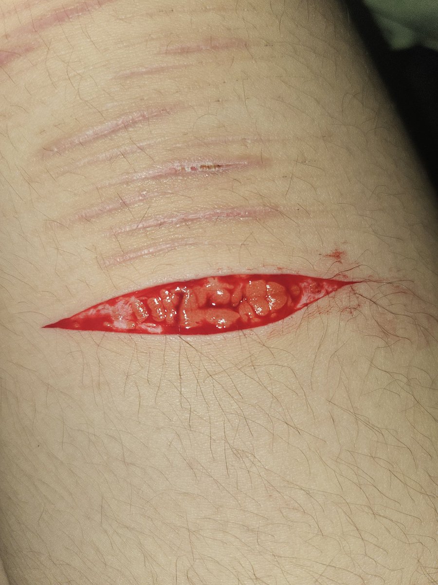 expiredworpse's tweet photo. Bean #selfharm https://t.co/5aEdmXBGmD