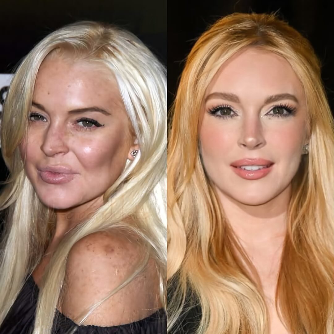 joiedevivre789's tweet image. Babies and food don’t change your face like that, plastic surgeons do 😂😂😂😂