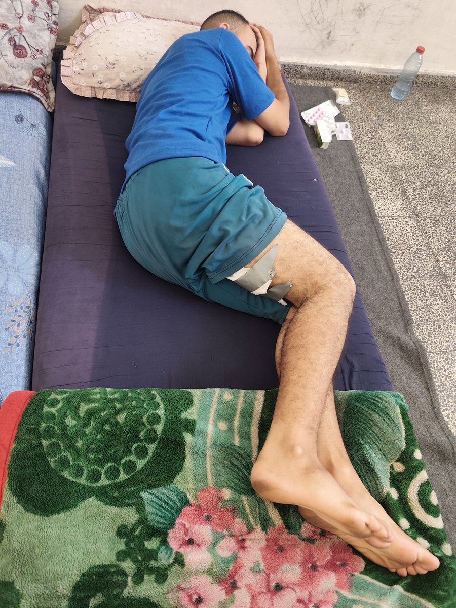 HaithamElmasri1's tweet image. Yesterday morning, warplanes targeted the shelter where my family and I live. Shrapnel flew everywhere, tearing through the space around us. I was injured in my leg, and my wife was wounded in her face. It was terrifyingโscreams mixed with the sound of destruction, and fearโฆ
