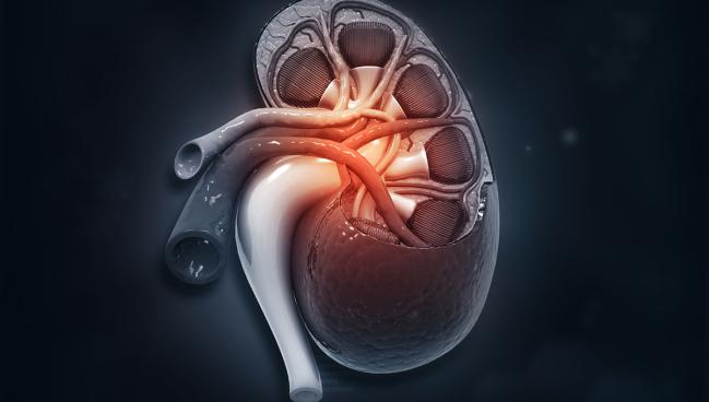 TCTMD's tweet image. Coverage for renal denervation for the treatment of uncontrolled hypertension has been proposed and issued by @CMSGov. If approved, it'll help ease uptake of the procedure that has been hindered by reimbursement issues. More here: tctmd.com/news/cms-issue…