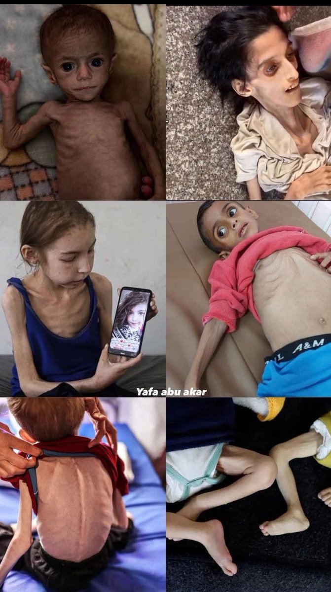 #فزعة_غزة

#عتق_رقبه_محمد__العمري "النظام المصري" #سجاد_بعوضه #السعوديه_مصر_ايد_واحده #سوريا_الان