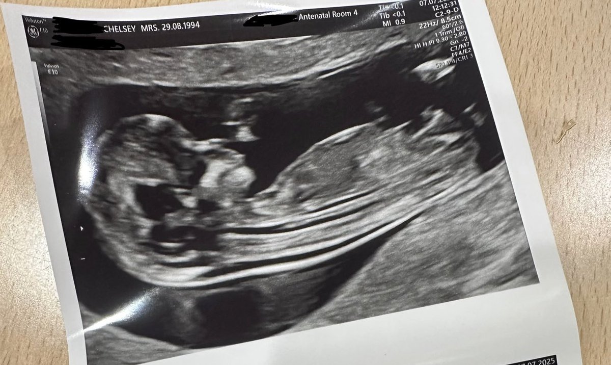 Around this time last year Dan and I found out I was pregnant for the first time, one month later we learned it was ectopic and couldn’t continue. 

One year later and we’re ready to finally meet our rainbow baby January 2026 🌈 👶🏻