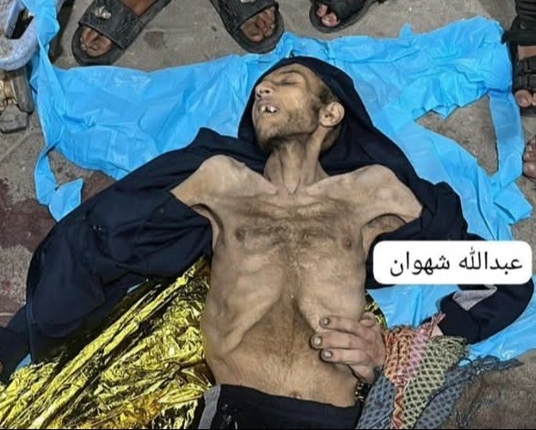 هذا المشهد لا يُحتمل…  
*محمد السوافيري*، من ذوي الاحتياجات الخاصة، مات جوعًا في غزة.  
لم يحمل سلاحًا، فقط جوعًا لم يُشبع.  
ليس رقمًا… بل روح أُزهقت بصمت.  
في عالم يفيض بالطعام، يُقتل إنسان لأنه جاع!

#غزة_تحت_الحصار #أنقذوا_غزة #جوع_حتى_الموت #إنسانية_في_الميزان