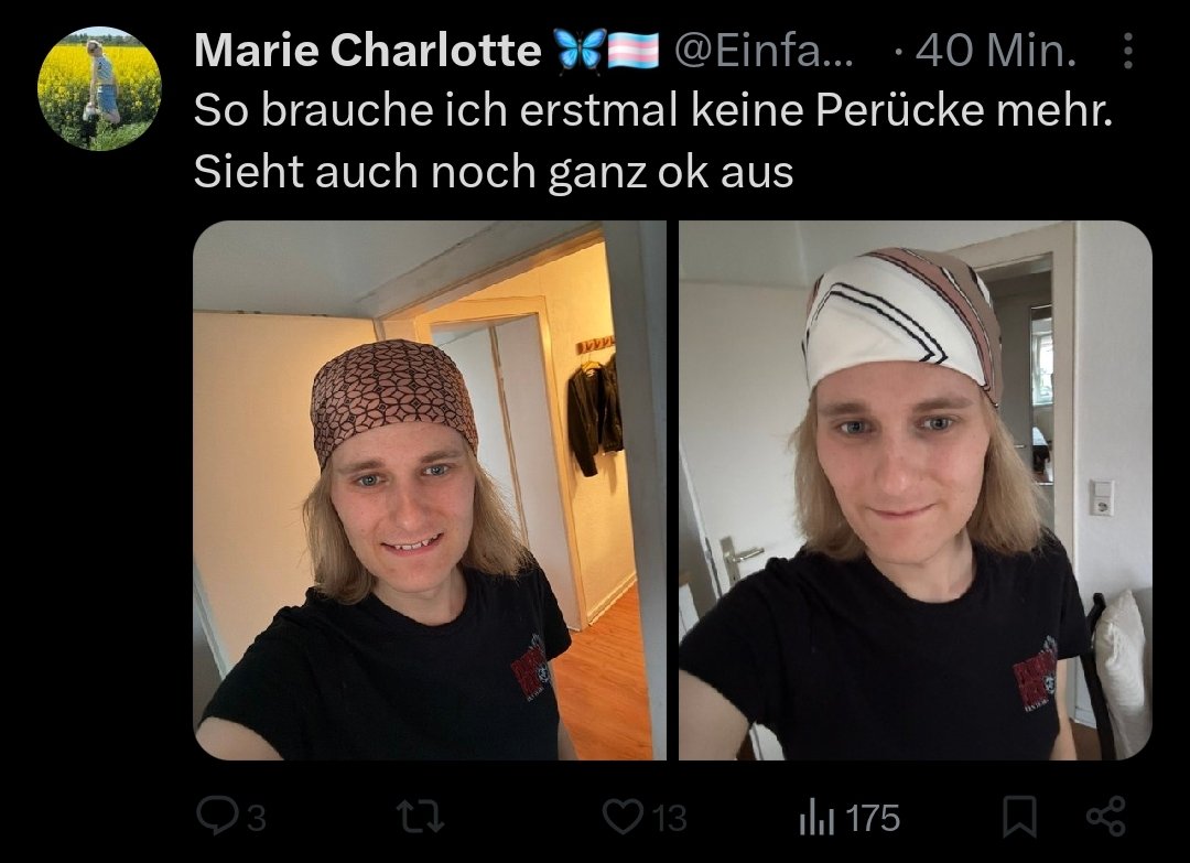 mannauskot's tweet image. Die Zinkmangelglatze ist des Transerichs grösster Feind.