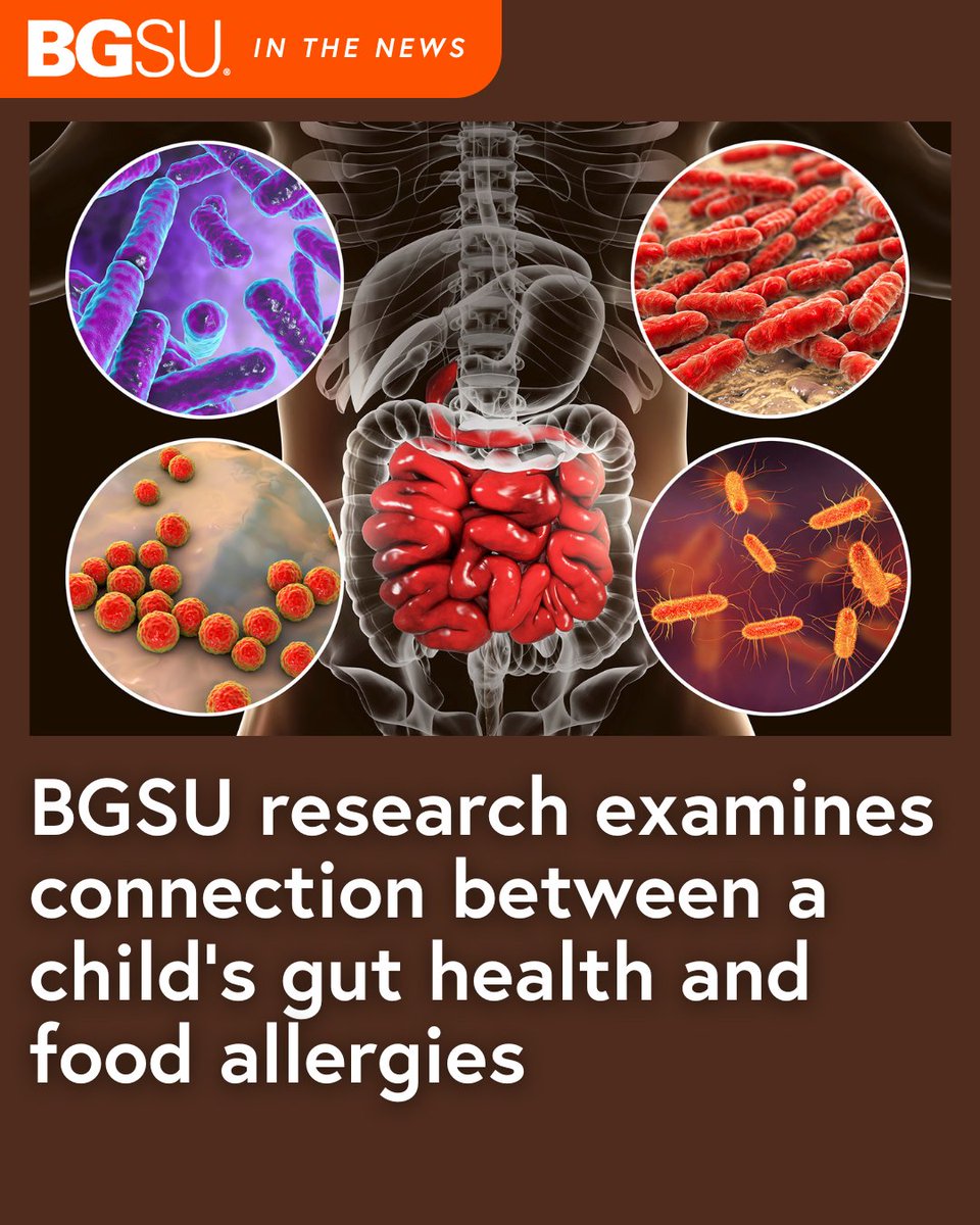 bgsu's tweet image. Do you know children affected by #FoodAllergies? BGSU may have discovered a way to help mitigate those allergies.
The details:
🟠 Preliminary results from BGSU research suggest that the gut microbiome may impact a person's susceptibility to food allergies
🟠 BGSU is partnering…