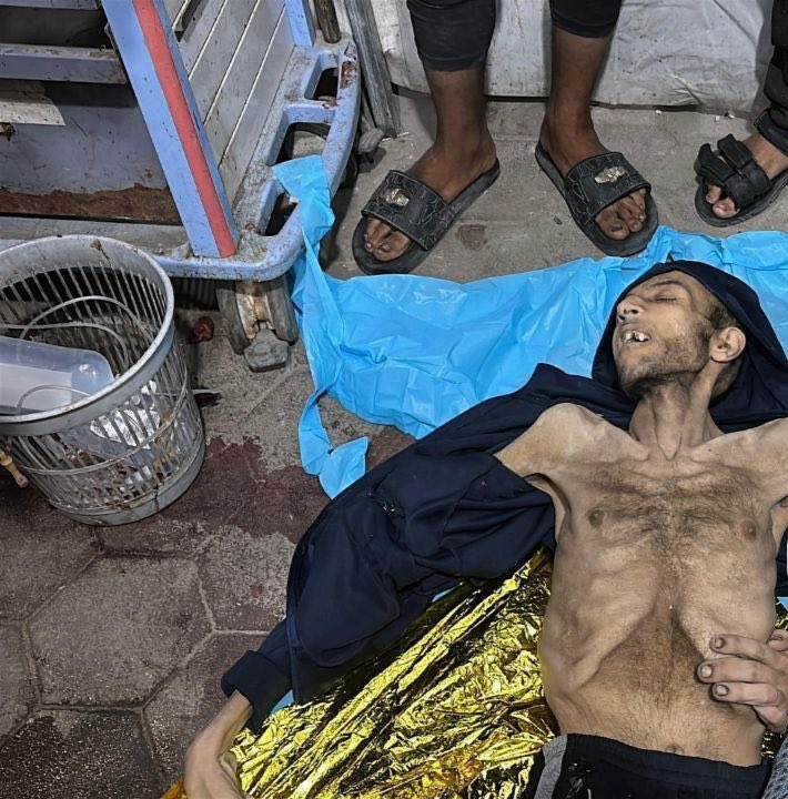 No words,
Shame on world,

This is Mohammed, A Gazan was killed today by Israeli occupation killing machine while seeking for a sack of flour to feed his kids.