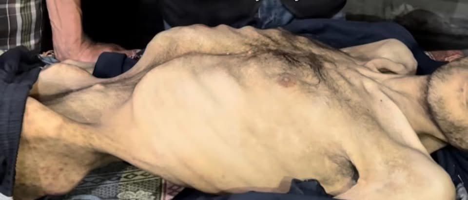 AhmedAAshour8's tweet image. This person was killed in Gaza by a silent, deadly weapon called hunger.
It is a weapon more brutal than rockets.
