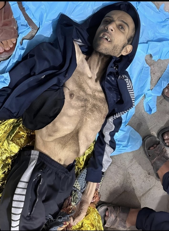 الجوع في غزة ينهش الصدور قبل البطون، يحاصر المساكن والمشافي والمدارس، يغلق أبواب الأفران والصيدليات والآبار، يطارد الأطفال في حضن أمهاتهم، ويخطف الضعفاء في طوابير المساعدات، ويُعلن على الملأ أن التجويع صار أداة إبادة.
#غزة_تقتل_جوعا
#جريمة_القرن