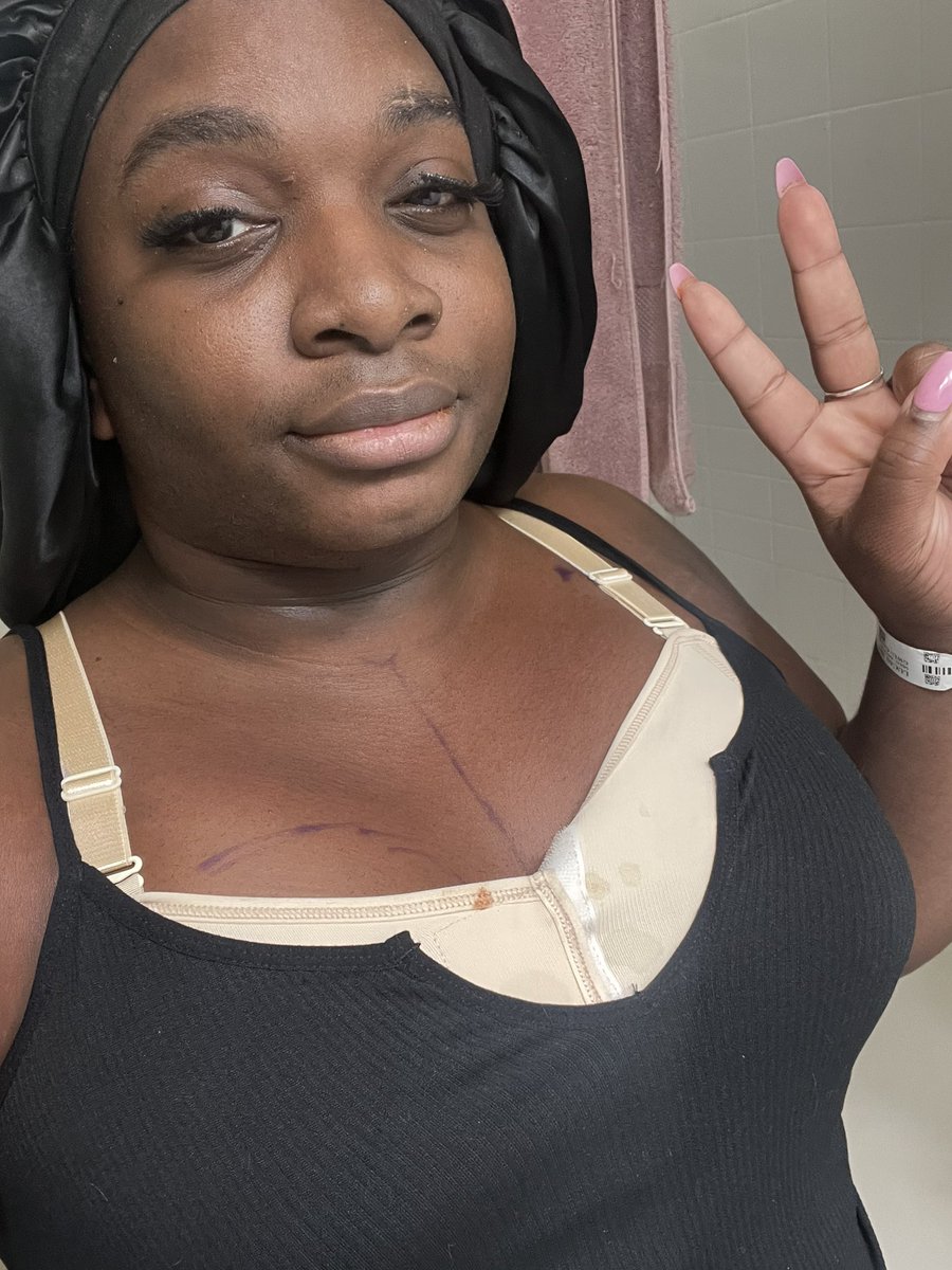 DixieGrayson23's tweet photo. I lived Bitch.
#breastaugmentation #mtftransition https://t.co/FIkhhtLGjC