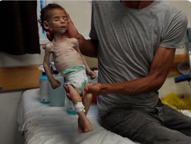 al_snd's tweet image. 19 حالة وفاة اليوم في #غزة بسبب الجوع.. بسبب الجوع.. بسبب الجوع!!

العالَم المُتخَم يشاهد على الهواء مباشرة الموت البطيء، والاحتضار جوعاً لأهل غزة.. ولا يحرك ساكناً!

أي سقوط للضمير الإنساني يشهده هذا العالم البائس؟!

#غزة_تجوع
#غزه_تموت_جوعا