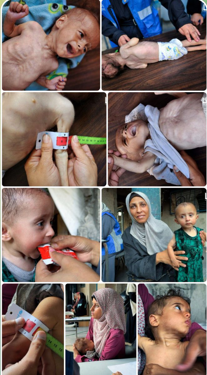 al_snd's tweet image. 19 حالة وفاة اليوم في #غزة بسبب الجوع.. بسبب الجوع.. بسبب الجوع!!

العالَم المُتخَم يشاهد على الهواء مباشرة الموت البطيء، والاحتضار جوعاً لأهل غزة.. ولا يحرك ساكناً!

أي سقوط للضمير الإنساني يشهده هذا العالم البائس؟!

#غزة_تجوع
#غزه_تموت_جوعا