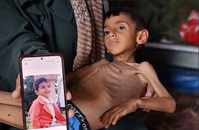 al_snd's tweet image. 19 حالة وفاة اليوم في #غزة بسبب الجوع.. بسبب الجوع.. بسبب الجوع!!

العالَم المُتخَم يشاهد على الهواء مباشرة الموت البطيء، والاحتضار جوعاً لأهل غزة.. ولا يحرك ساكناً!

أي سقوط للضمير الإنساني يشهده هذا العالم البائس؟!

#غزة_تجوع
#غزه_تموت_جوعا