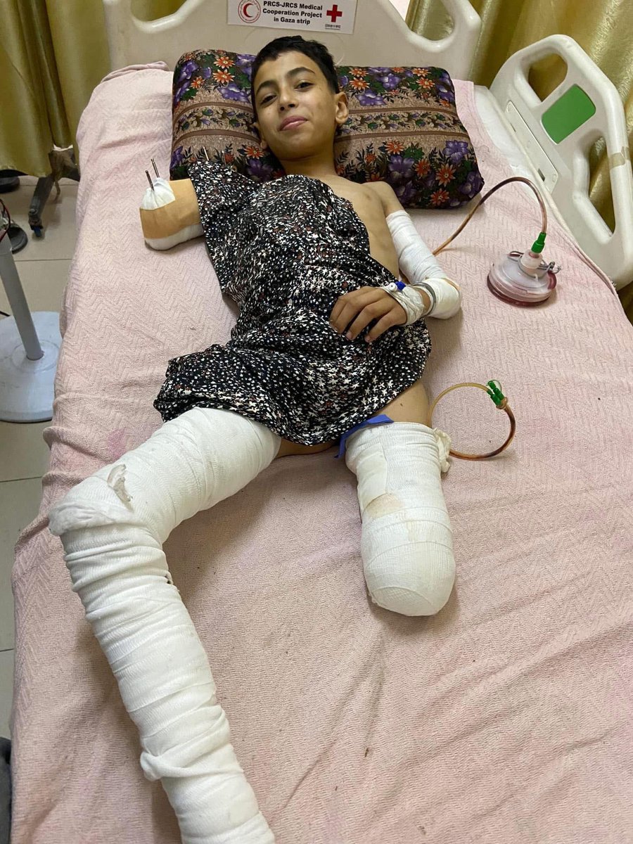RamAbdu's tweet photo. The shortage of anesthesia supplies in hospitals, caused by Israel’s restrictions on their free access, is causing children to wake up during surgeries. 💔
Samir is one of these children. https://t.co/bROfpbSK1A