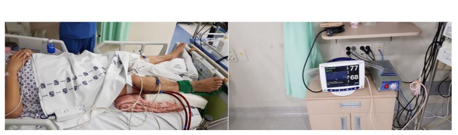 ArtifOrgans's tweet image. #NearInfraredSpectroscopy for Preventing #LimbIschemia in #ECMO
👉tinyurl.com/mpzrwyxp
#Bucheon🇰🇷| #DistalPerfusion #NIRS